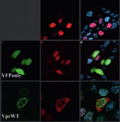 1: SIV Nef expression inhibits transferrin uptake MIP HIV-GFP infected THP-I cells were incubated with Tf-Alexa647 and allowed to internalize for 10min.