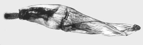 Endoparasitosen Kratzer (Acanthocephala, z.b.