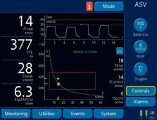 des Patienten abstimmen. Konfigurierbares Ventilation Cockpit Sie können die Anzeige der Monitoring-Daten für den Patienten im Ventilation Cockpit nach Ihren Wünschen konfigurieren.