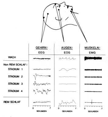 Abbildung 2-3 Abb. 2.3: Schlafstadien. Die Schlafstadien werden aus Stromkurven bestimmt, die vom Gehirn, den Augen und den Muskeln abgeleitet werden.