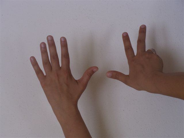 3.1.3 Überprüfungsaufgabe 3 Der Schüler soll 8 Finger zeigen.