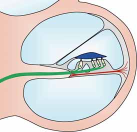 10 0 Nervenfasern Tektorialmembran Innere Haarzellen Äussere Haarzellen Basilarmembran Bild 31: Querschnitt durch die Hörschnecke.