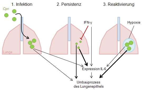 Diskussion 97 Abbildung 6.2: Modell zu C. pneumoniae induzierten Umbauprozessen. (1) C. pneumoniae infiziert Lungenepithelzellen was zu einer akuten Infektion führt.