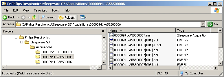 Dateien und Ordner in Version Sleepware G3 Aufzeichnungsordner In Sleepware G3 bildet ein Aufzeichnungsordner das Grundelement einer Aufzeichnung.