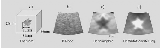 Abbildung 2: Darstellung eines Gelatinemodells (a) zur Bestimmung der Gewebeelastizität mittels Sonographie.