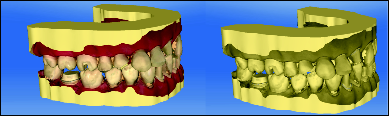7 Seitenpalette Sirona Dental Systems GmbH 7.4 Analyse-Werkzeuge 7.