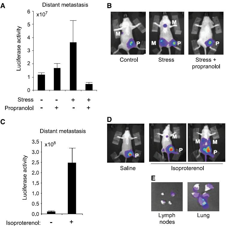 Sympathicus und neuroendokrine Stimulation der Metastasierung β-adrenergic signaling increases the infiltration of CD11b+F4/80+