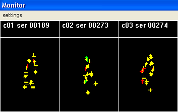 Ergebnis: Optisches Echtzeitsystem Messen der