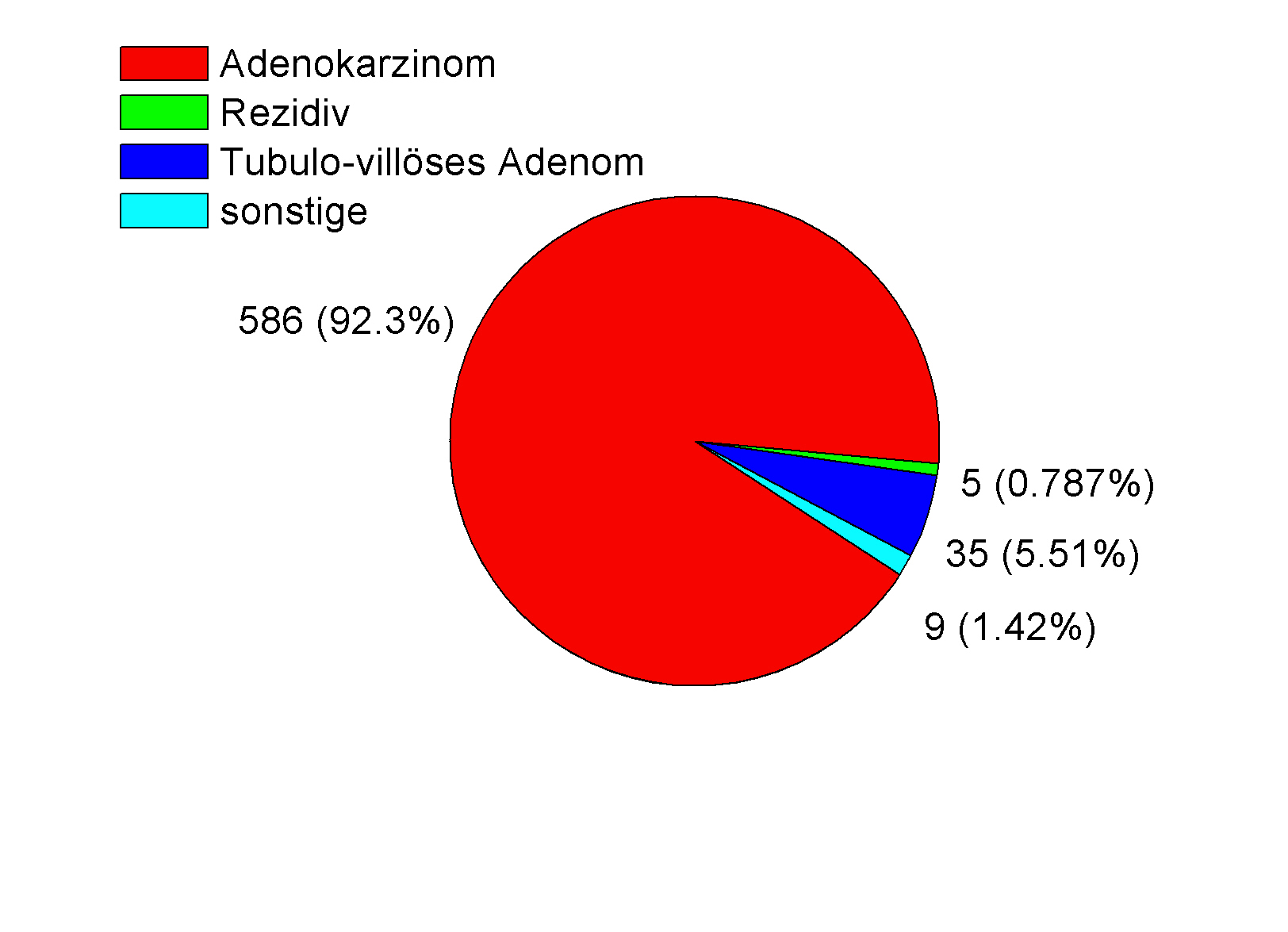 3.4. Tumore Die meisten Rektumkarzinome waren zu 92,3 % Adenokarzinome. Tubulovillöse Adenome, das Vorläuferstadium des Adenokarzinoms, stellten 5,5 % dar.