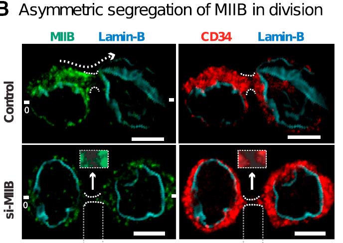 Die polarisierte Expression von Myosin IIB (MIIB) fördert