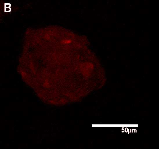 3-12: MEF2D (rot); A: nur wenig über dem Hintergrund fluoreszierendes Signal an zwei undeutlich erkennbaren CS; B: eine Kardiosphäre mit einzelnen etwas schwer abgrenzbaren Aufhellungen in