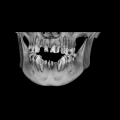 de Bildgebende Verfahren boomen Röntgen Ultraschall Durchleuchtung Magnetresonanztomographie Angiographie www.barmer-gek.de Warum braucht man bildgebende Systeme?? Sucht nach bildlicher Information?
