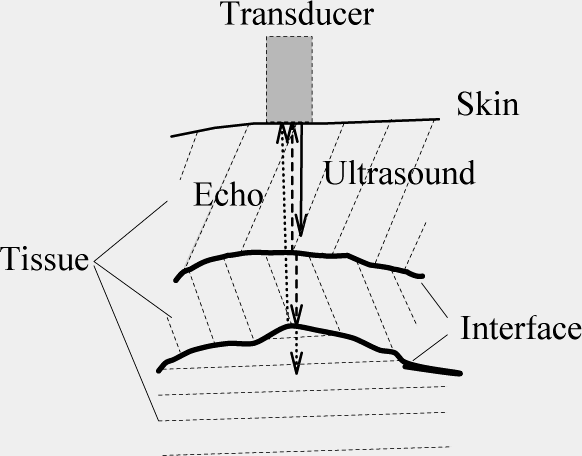 Medical Volume Data - 3D-US sound waves (1-15 MHz) are reflected at interfaces (e.g.