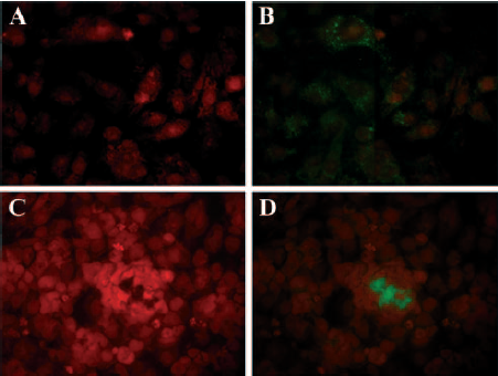 3 Ergebnisse Abb. 3.1: Fluoreszenzbilder der Aufnahme von APTS Hydroxyethylstärke (grün) in HK 2 Zellen. Für die Bilder wurden HK 2 Zellen für 21 Stunden mit 4,35% APTS HES 130 / 0,4 inkubiert.
