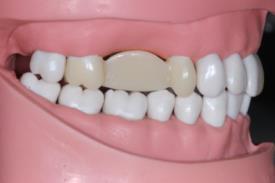 Vorklinik Ausbildung: Hoher Anteil praktischer Übungen Grundlagen der Verarbeitung dentaler Biomaterialen Simulation klinischer