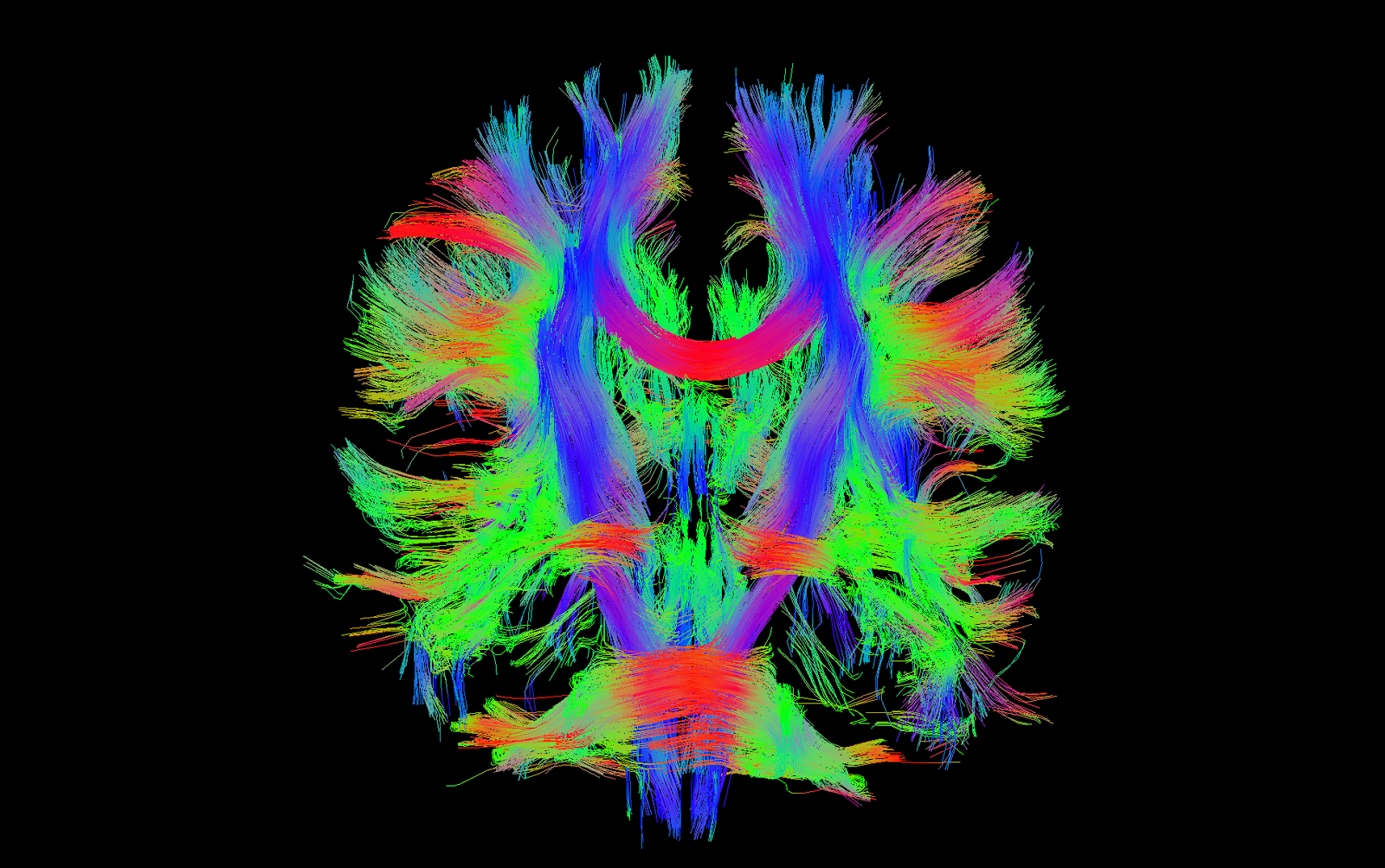 Einleitung Abbildung 2: Unter dem Begriff Konnektom versteht man die Gesamtheit der Nervenleitungen im Gehirn.