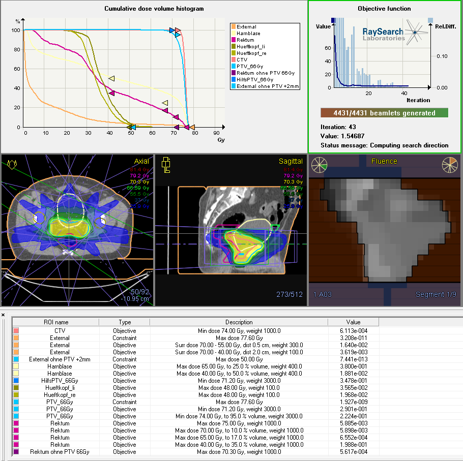 Abbildung 18: Inverse Optimierung eines IMRT-Bestrahlungsplans für ein Prostata-Karzinom (verordnete Zielvolumendosis: 74 Gy) anhand definierter Dosis-Zielvorgaben für Zielvolumen (CTV, PTV) und