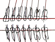 Schiefe Zähne Die Straight-Wire-Anatomie der allgemeinen Kieferorthopädie / Orthodontie, auch Dentofacial Orthopedics Falsche Ausrichtung der Zähne und der Okklusion, Schiefe Zähne : Die