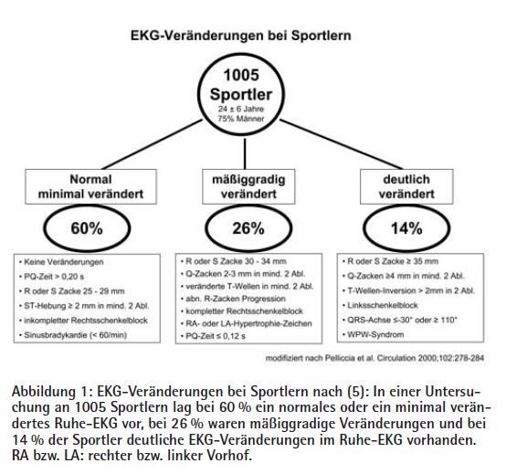 1 Einleitung Abbildung 5: EKG-Veränderungen bei Sportlern (Scharhag 2007) 1.4.1. Kriterien der European Society of Cardiology zur Evaluation des Sportler-EKG 2010 veröffentlichte die European Society