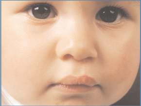 Mund-, Kiefer- und Gesichtschirurgie Lippen-Kiefer-Gaumenspalten Informationen und Ratschläge für Eltern und Patienten