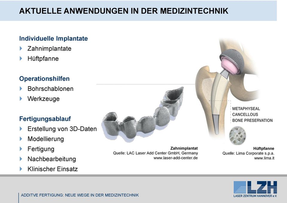 3D-Daten Modellierung Fertigung Nachbearbeitung Klinischer Einsatz Zahnimplantat Quelle:
