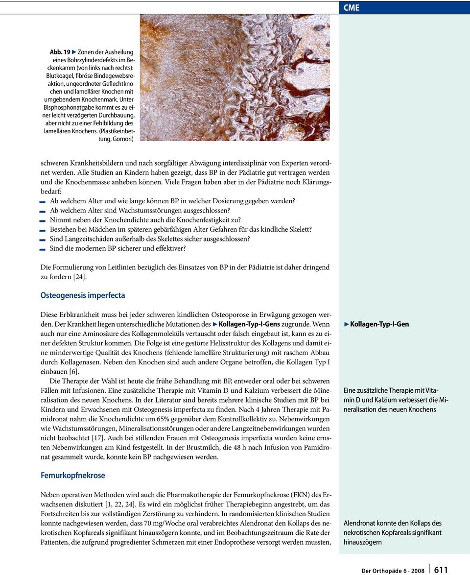 Knochenmark. Unter Bisphosphonatgabe kommt es zu einer leicht verzögerten Durchbauung, aber nicht zu einer Fehlbildung des lamellären Knochens.