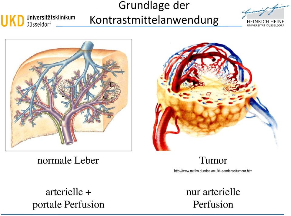 dundee.ac.uk/~sanderso/tumour.