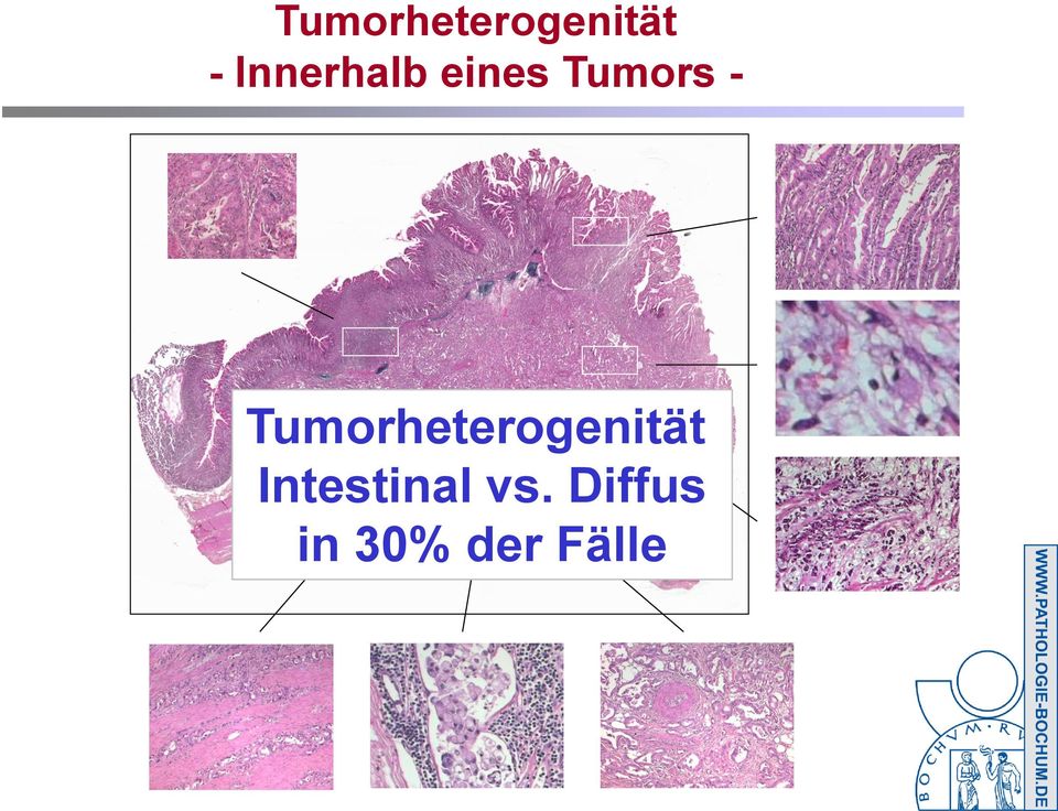 Tumorheterogenität