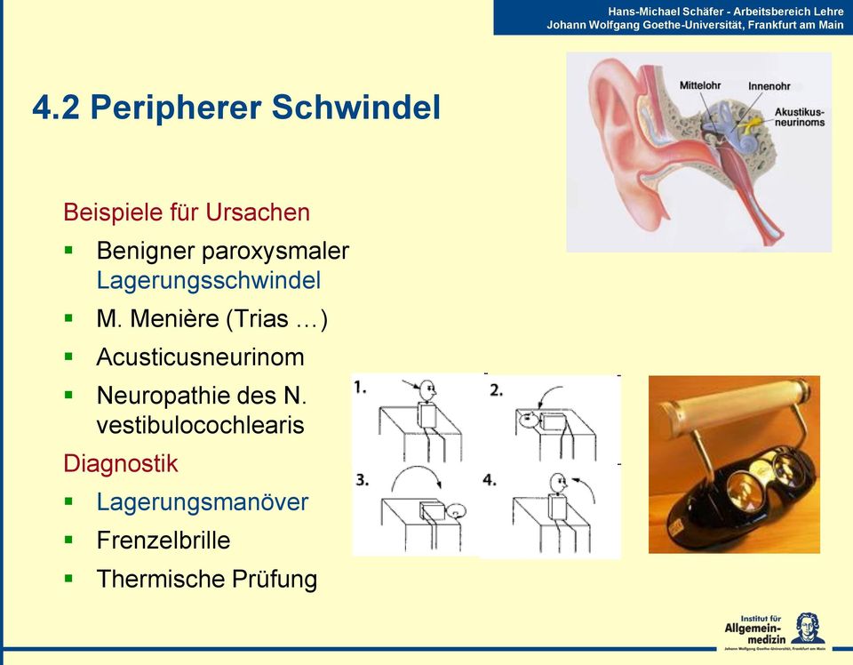 Menière (Trias ) Acusticusneurinom Neuropathie des N.