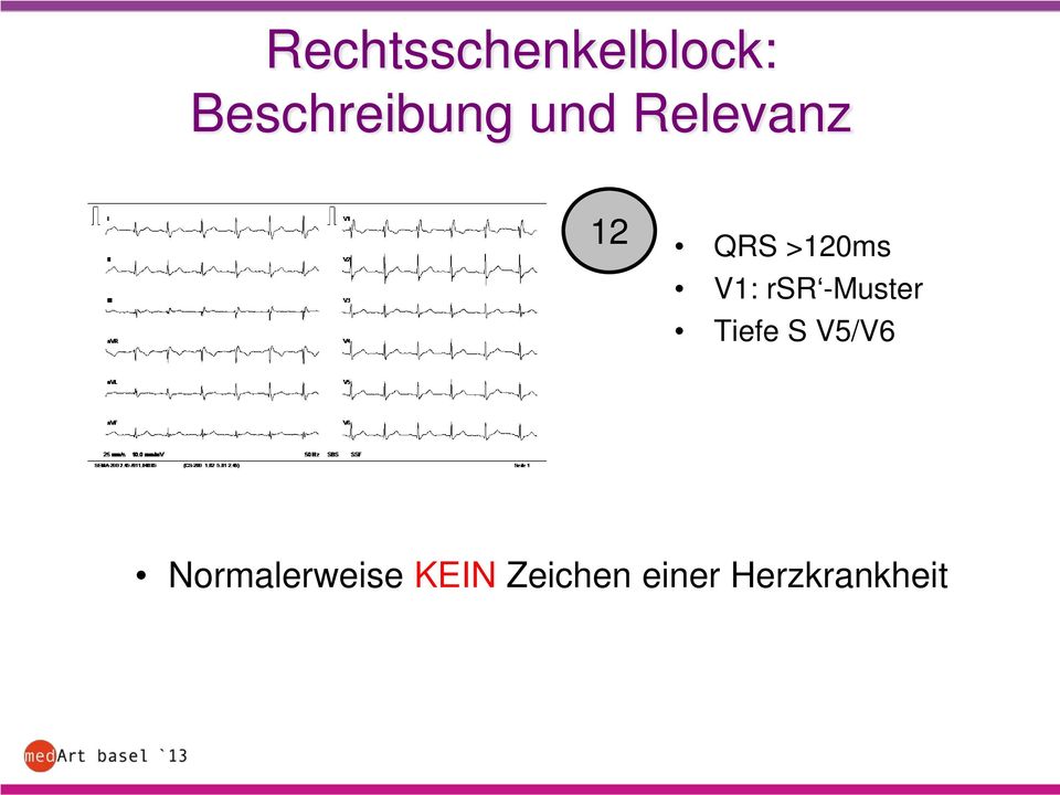 -Muster Tiefe S V5/V6