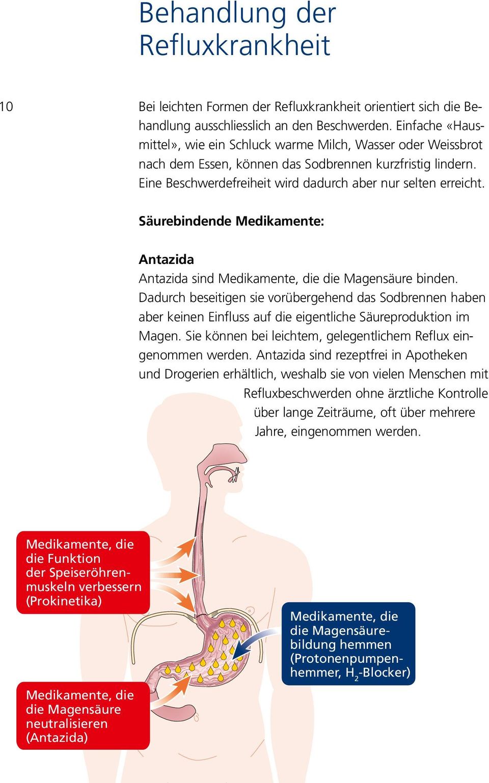 Säurebindende Medikamente: Antazida Antazida sind Medikamente, die die Magensäure binden.
