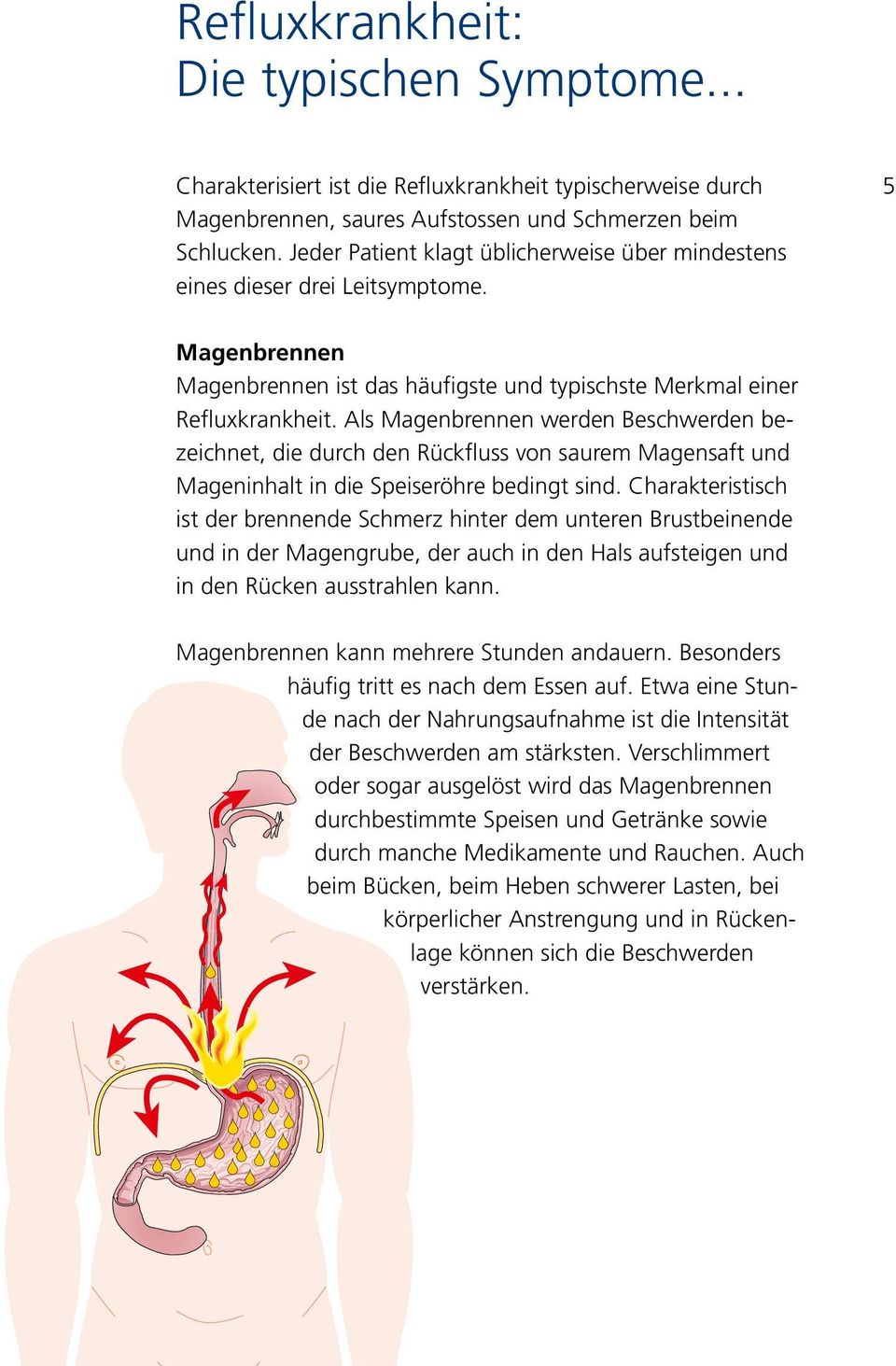 Als Magenbrennen werden Beschwerden bezeichnet, die durch den Rückfluss von saurem Magensaft und Mageninhalt in die Speiseröhre bedingt sind.