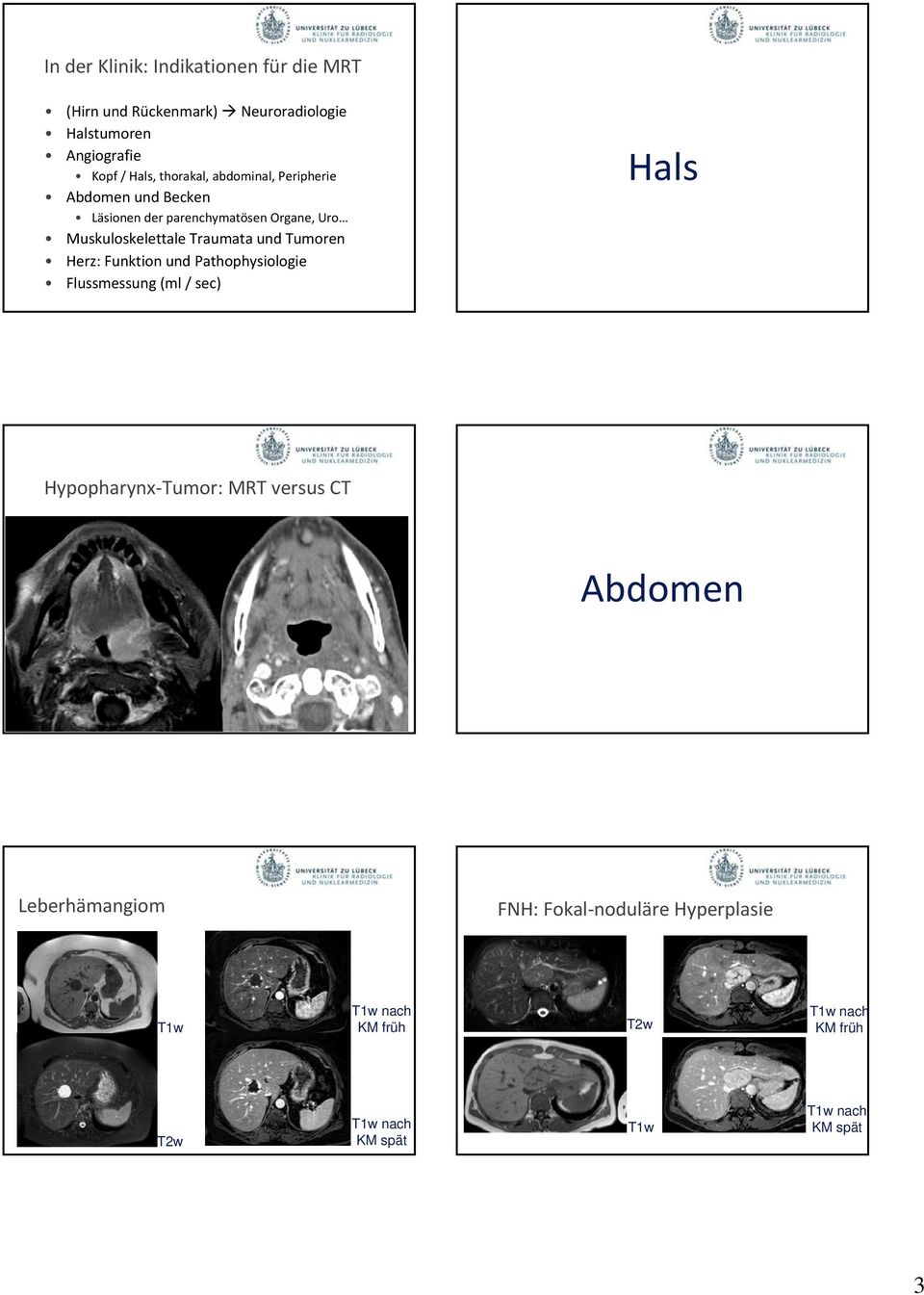 und Tumoren Herz: Funktion und Pathophysiologie Flussmessung (ml / sec) Hals Hypopharynx Tumor: MRT versus CT Abdomen