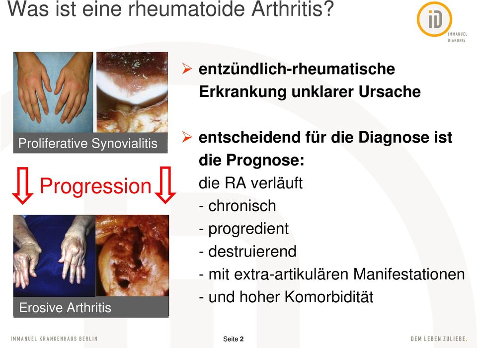 Progression Erosive Arthritis entscheidend für die Diagnose ist die Prognose: