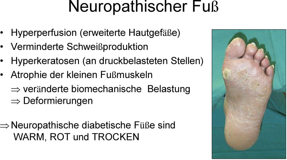 Stellen) Atrophie der kleinen Fußmuskeln veränderte biomechanische