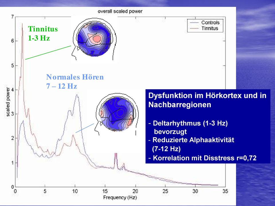 - Deltarhythmus (1-3 Hz) bevorzugt - Reduzierte