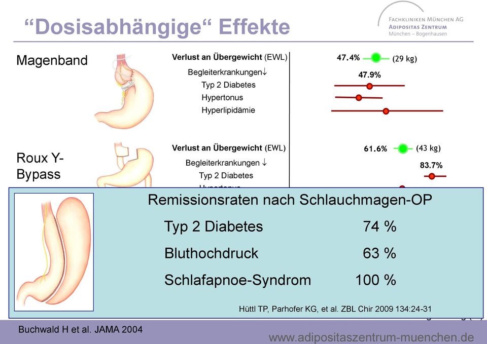 7% Typ 2 Diabetes Hypertonus Remissionsraten Hyperlipidämie nach Schlauchmagen-OP Typ 2 Diabetes 74 % Verlust an Übergewicht (EWL) 70.