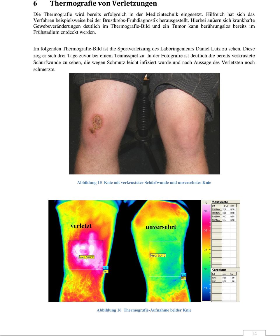 Hierbei äußern sich krankhafte Gewebsveränderungen deutlich im Thermografie-Bild und ein Tumor kann berührungslos bereits im Frühstadium entdeckt werden.