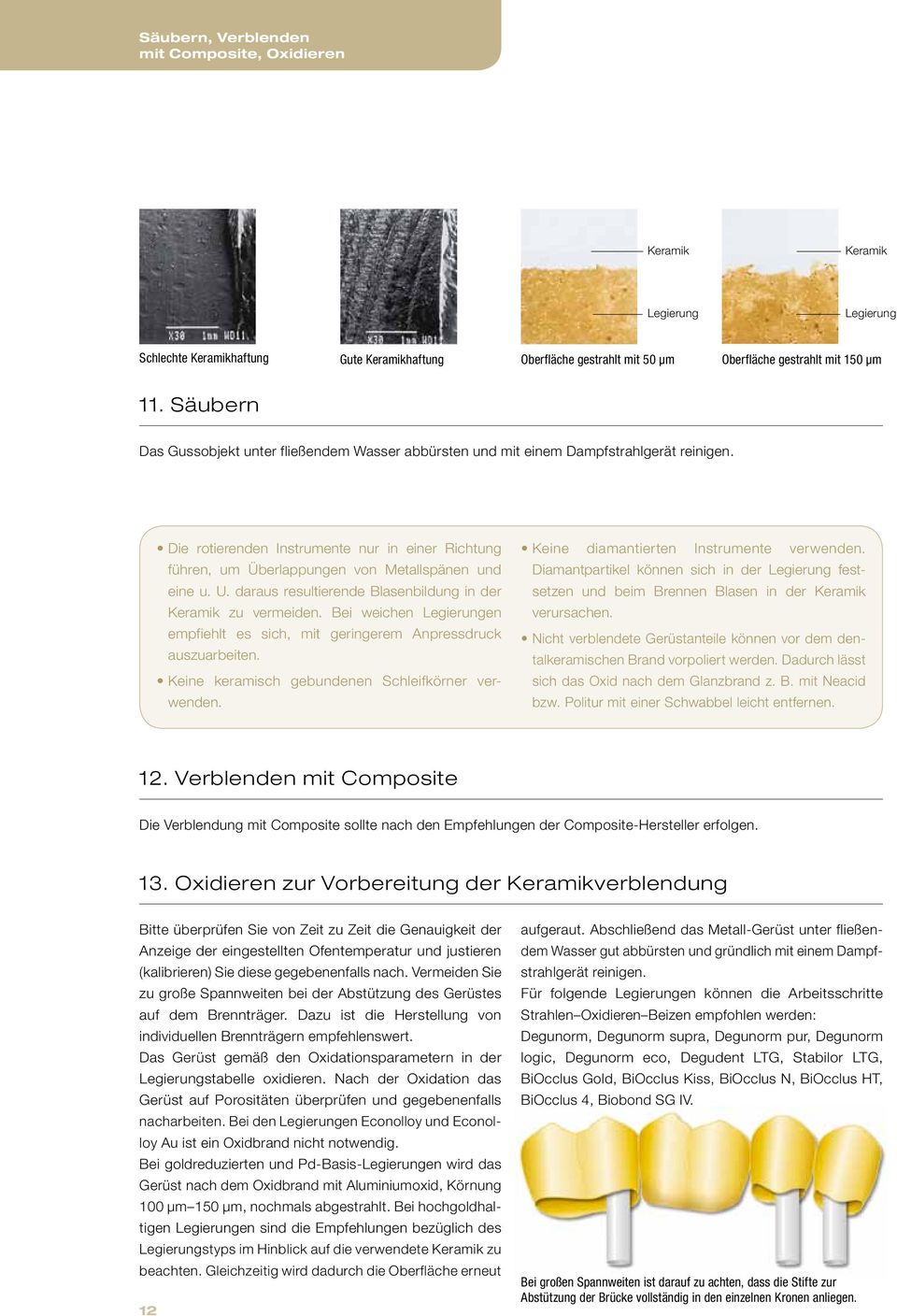 Die rotierenden Instrumente nur in einer Richtung führen, um Überlappungen von Metallspänen und eine u. U. daraus resultierende Blasenbildung in der Keramik zu vermeiden.