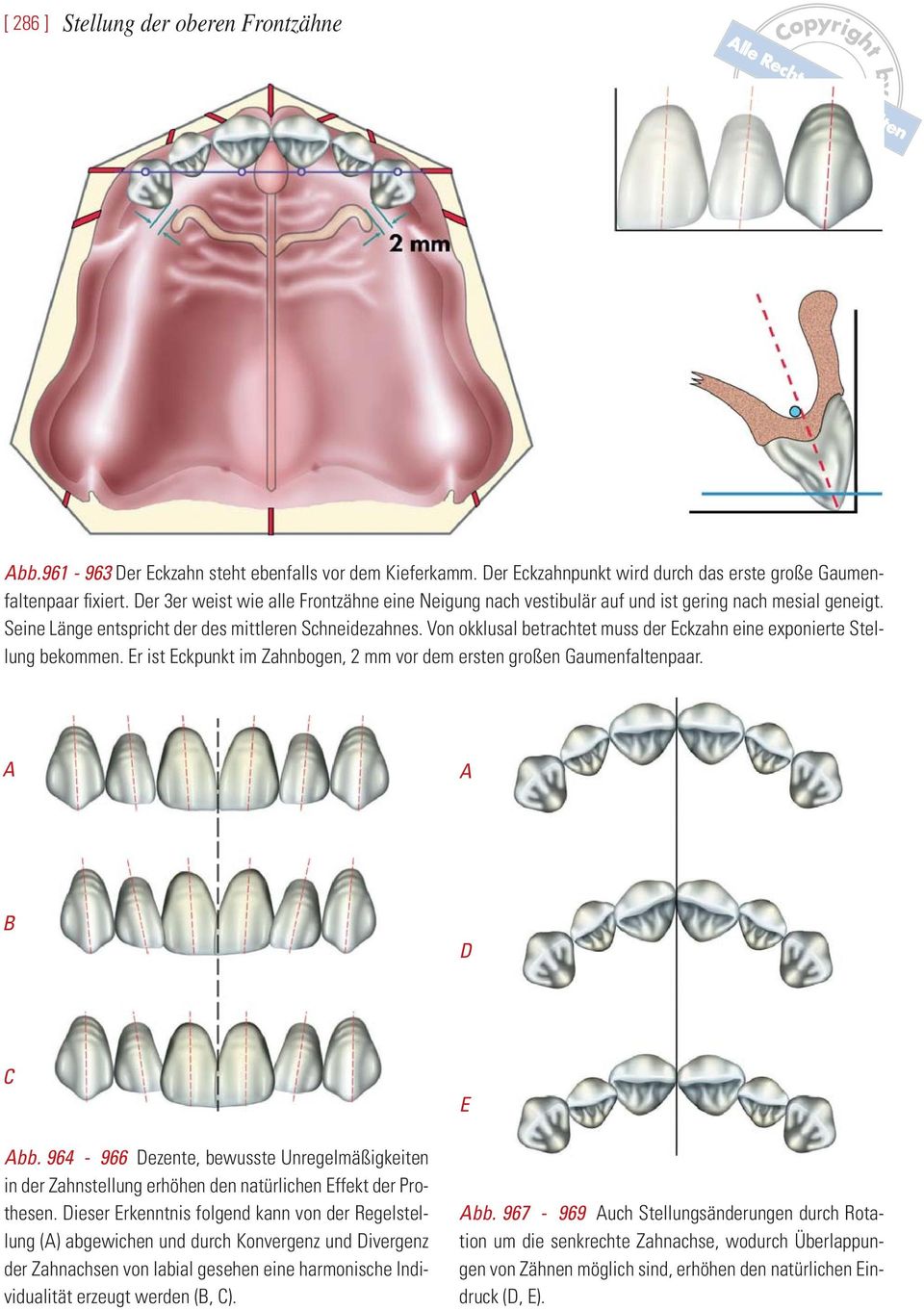 Von okklusal betrachtet muss der Eckzahn eine exponierte Stellung bekommen. Er ist Eckpunkt im Zahnbogen, 2 mm vor dem ersten großen Gaumenfaltenpaar. A A B D C Abb.