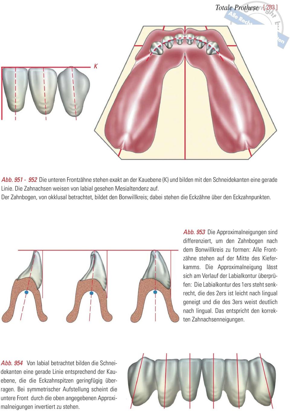 953 Die Approximalneigungen sind differenziert, um den Zahnbogen nach dem Bonwillkreis zu formen: Alle Frontzähne stehen auf der Mitte des Kieferkamms.