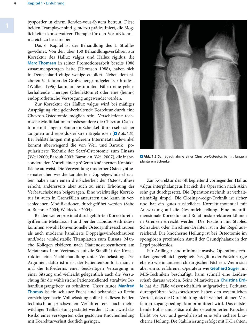 Von den über 150 Behandlungsverfahren zur Korrektur des Hallux valgus und Hallux rigidus, die Marc Thomsen in seiner Promotionsarbeit bereits 1988 zusammengetragen hatte (Thomsen 1988), haben sich in