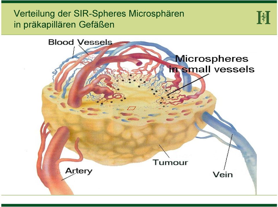 Microsphären in