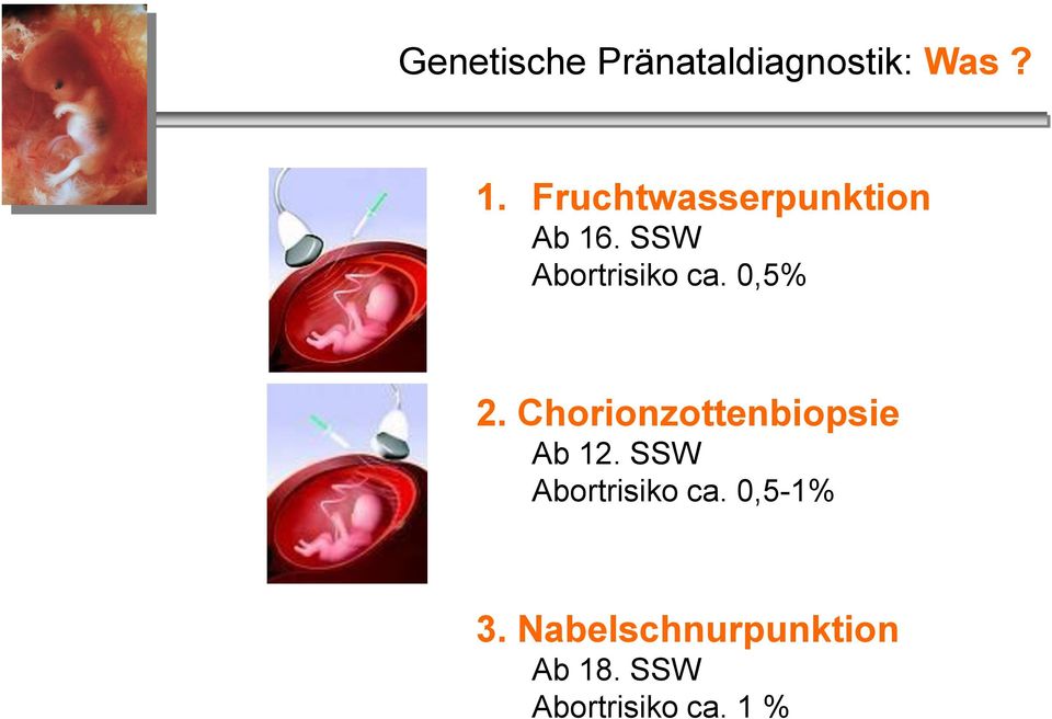 0,5% 2. Chorionzottenbiopsie Ab 12.