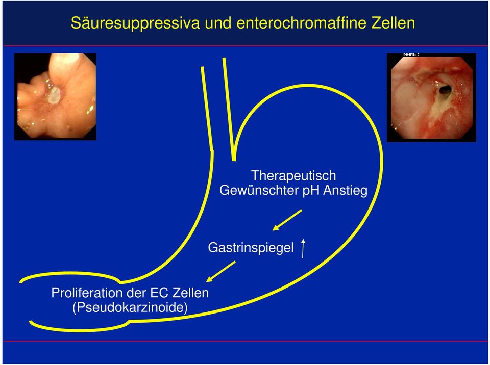 Therapeutisch Gewünschter ph