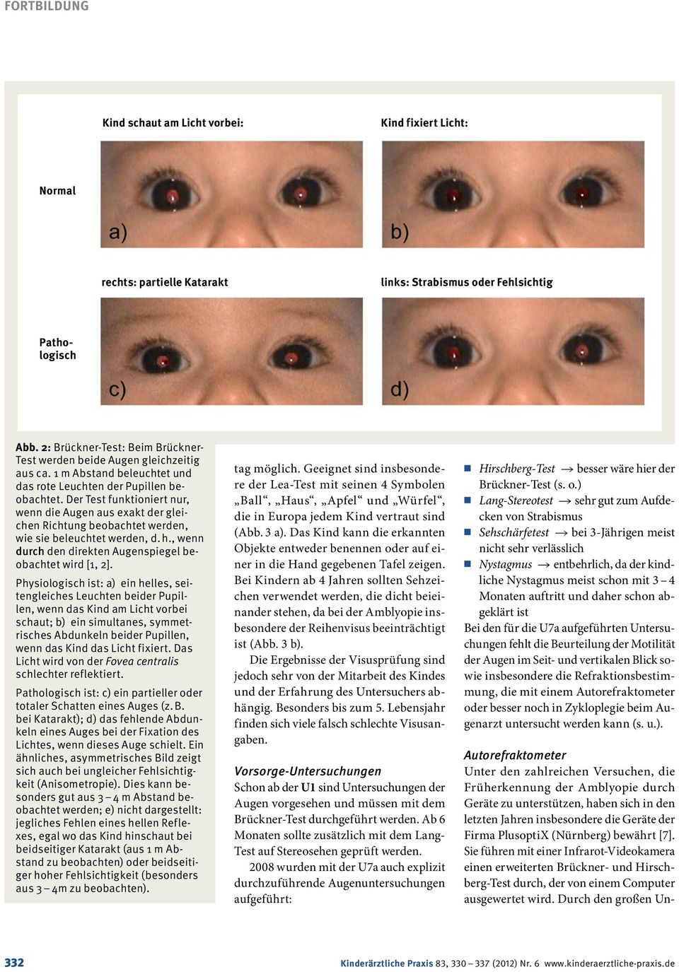 Der Test funktioniert nur, wenn die Augen aus exakt der gleichen Richtung beobachtet werden, wie sie beleuchtet werden, d. h., wenn durch den direkten Augenspiegel beobachtet wird [1, 2].