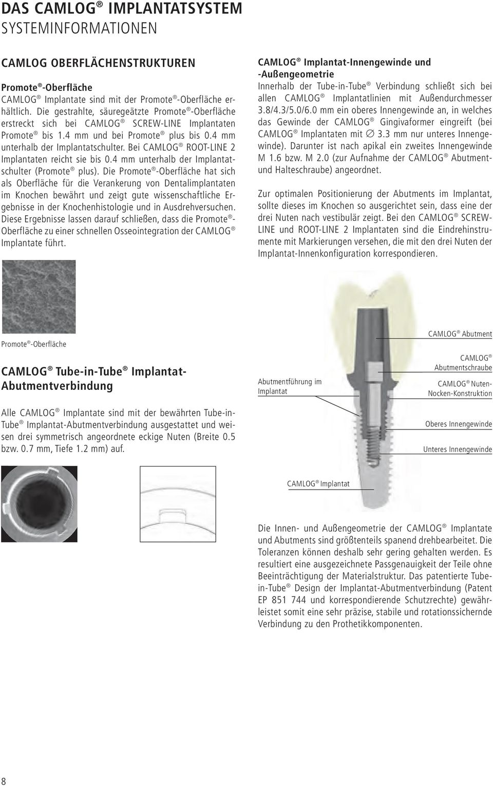 Bei CAMLOG ROOT-LINE 2 Implantaten reicht sie bis 0.4 mm unterhalb der Implantatschulter (Promote plus).