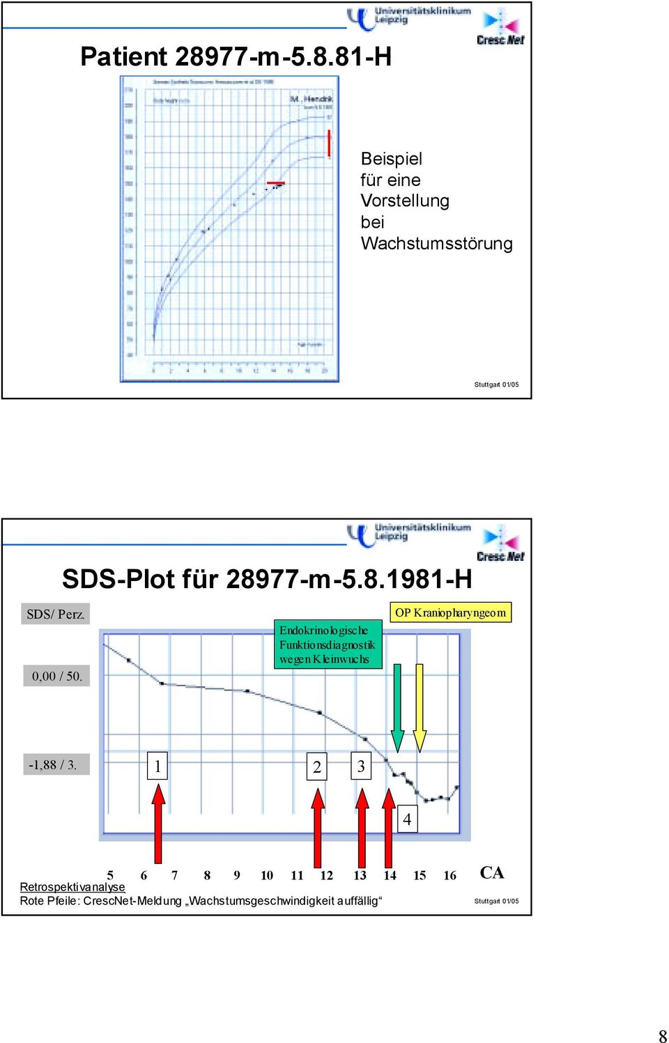 81-H Beispiel für eine Vorstellung bei Wachstumsstörung SDS-Plot für 2891981-H SDS/