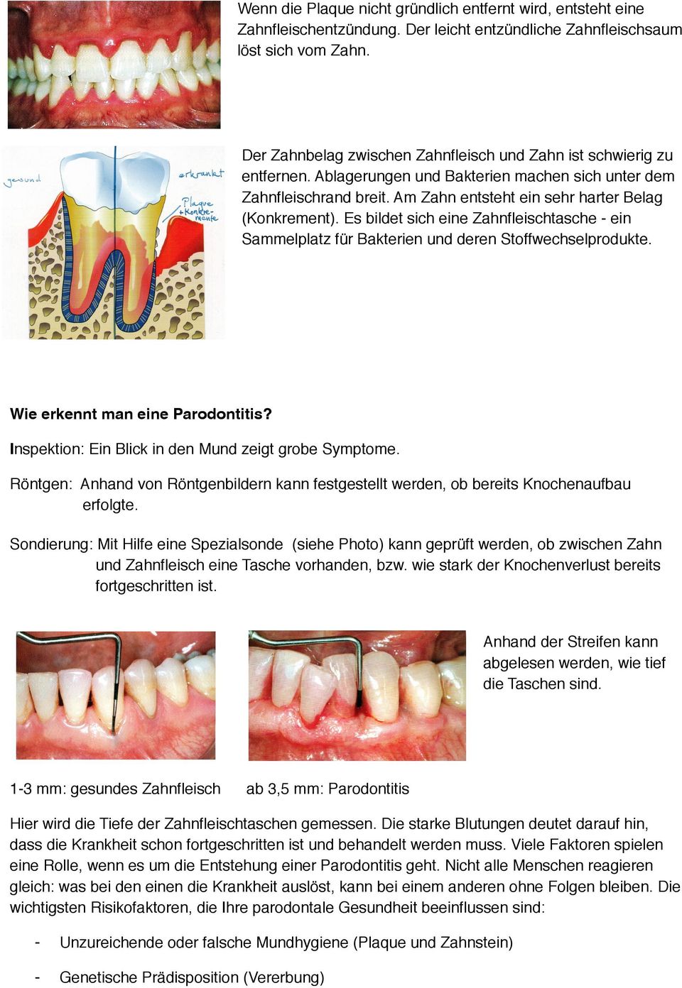 Es bildet sich eine Zahnfleischtasche - ein Sammelplatz für Bakterien und deren Stoffwechselprodukte. Wie erkennt man eine Parodontitis? Inspektion: Ein Blick in den Mund zeigt grobe Symptome.