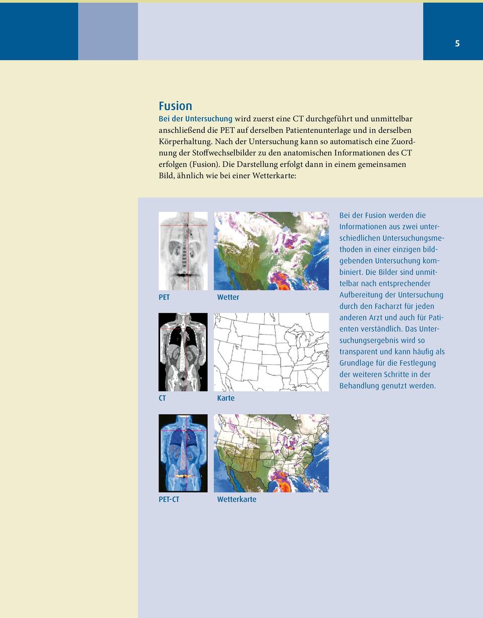 Die Darstellung erfolgt dann in einem gemeinsamen Bild, ähnlich wie bei einer Wetterkarte: PET CT Wetter Karte Bei der Fusion werden die Informationen aus zwei unterschiedlichen Untersuchungsmethoden